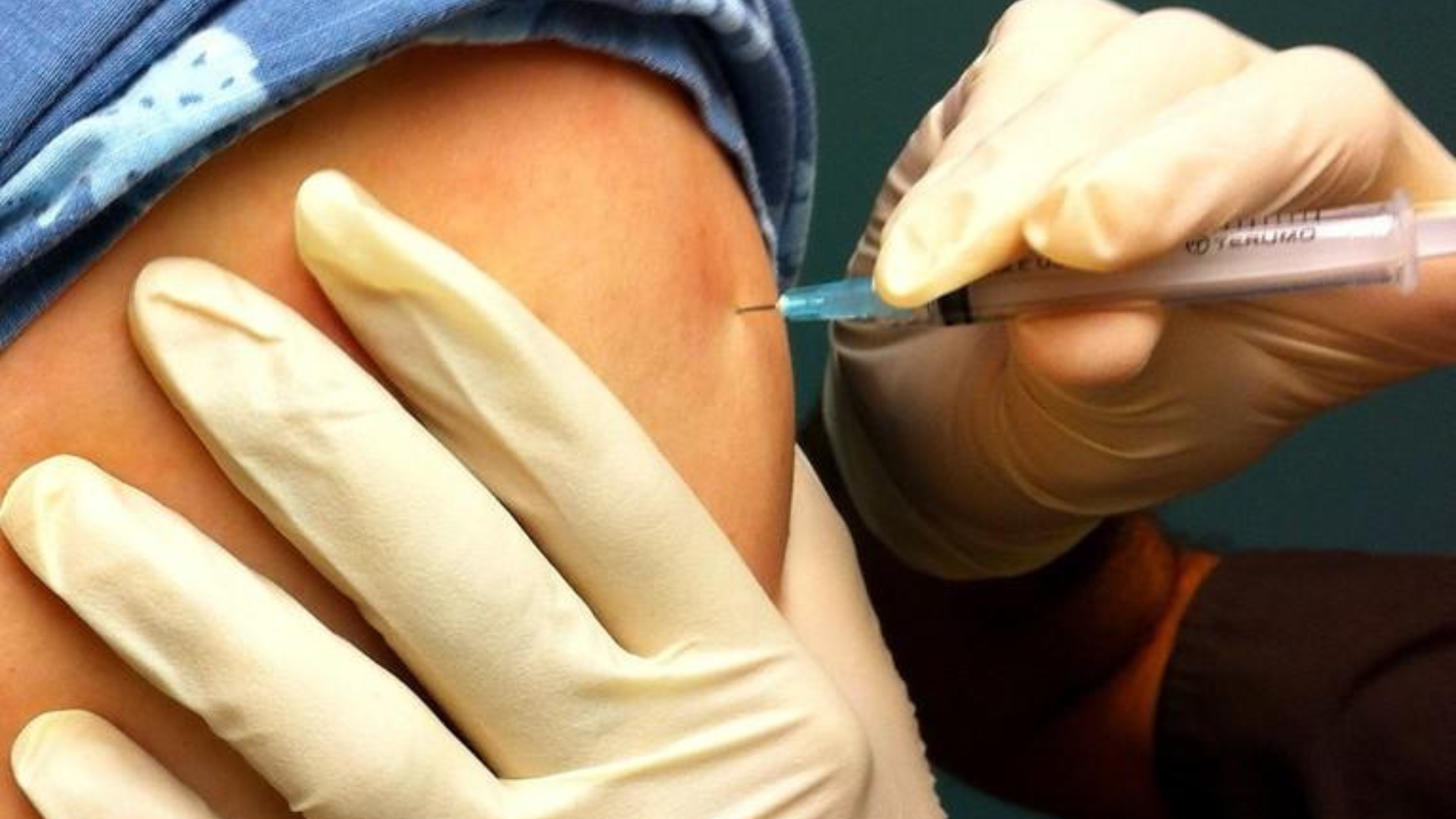 Study: Vaccinated patients have lower risk of long COVID